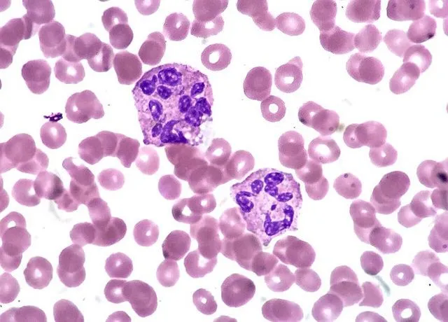 neutrophils_cancer